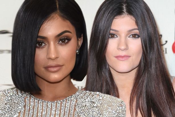 Kylie Jenner : 20 ans et déjà amoureuse du Botox !