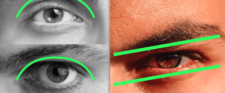 Chirurgie Hunter Eyes pour les Hommes : Améliorez Votre Regard Masculin