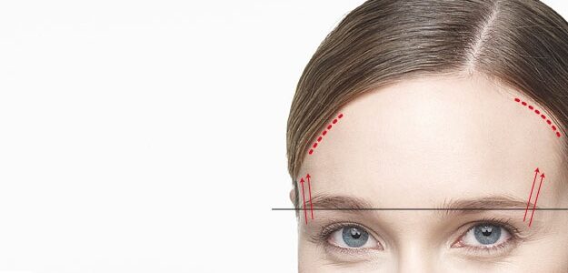 A quel âge peut-on envisager une blépharoplastie ou lifting sourcils ? blepharoplastie ou lifting sourcils