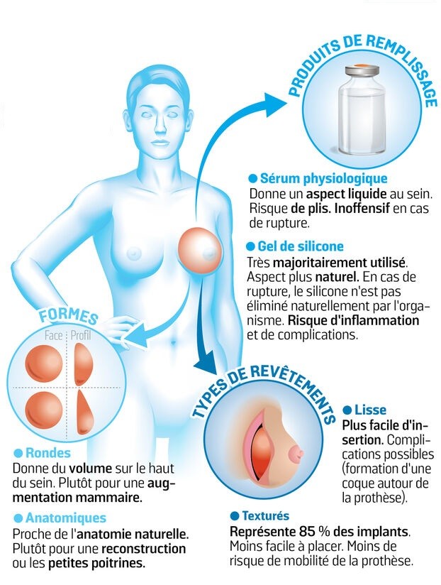 forme implant mammaire