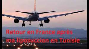 prendre avion apres liposuccion