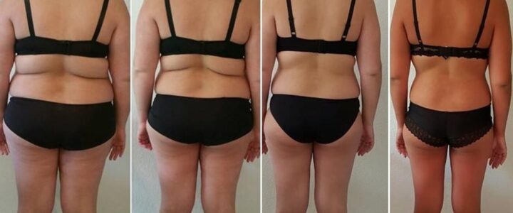 Comment accélérer la perte de poids après une sleeve