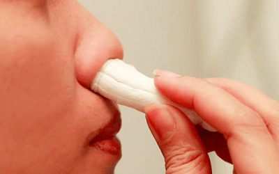combien-de-temps-garde-t-on-les-meches-apres-une-rhinoplastie