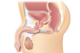 chirurgie de la prostate