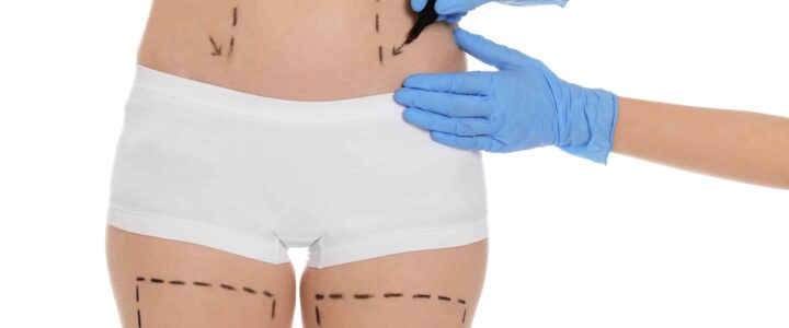 pansement liposuccion