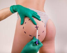 BBL Endoscopique : Guide Complet sur l’Augmentation Fessière Assistée par Endoscopie