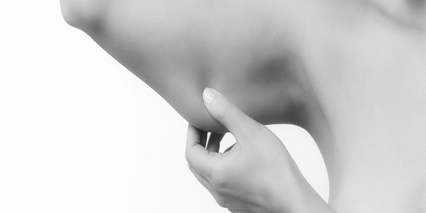 Adieu les Bras Flasques : Guide Complet du Quantum Lifting Bras (RFAL)