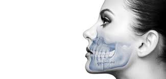 double jaw surgery turkey