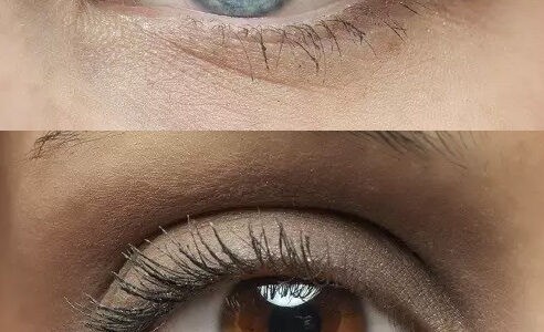 Package Kératopigmentation et Chirurgie Esthétique en Turquie