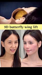 9D butterfly wing lift