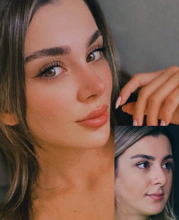 keratopigmentation+barbie nose surgery turquie