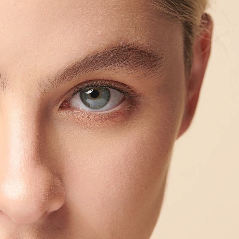 winged blepharoplasty turkey