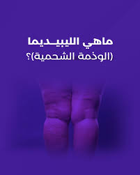كيف تعرفين أنك مصابة بالليبيديما