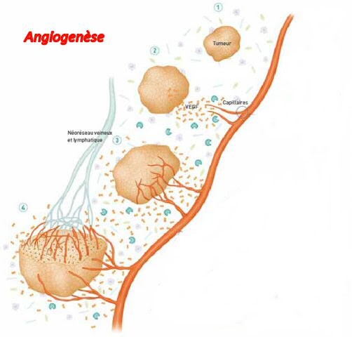 angiogenese lipoedeme