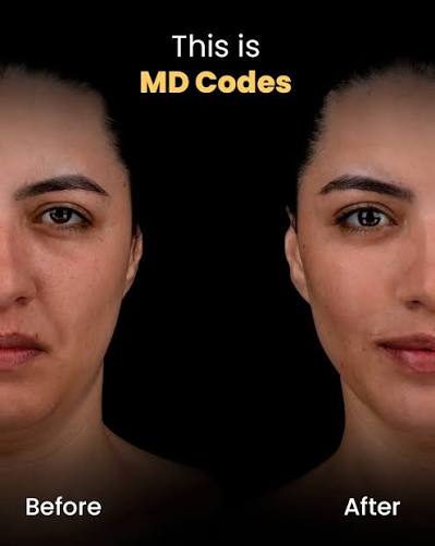 MD Codes full face